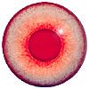 Albino Eyes Round Pupil